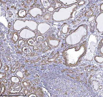 Drebrin/DBN1 Mouse Monoclonal Antibody