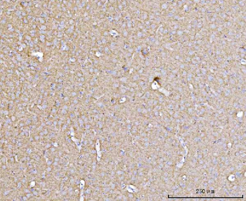 Drebrin/DBN1 Mouse Monoclonal Antibody