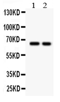 TGF beta Receptor II/TGFBR2 Rabbit Polyclonal Antibody