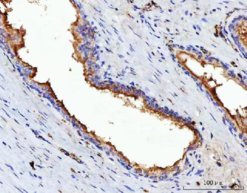 VPAC2/VIPR2 Rabbit Polyclonal Antibody
