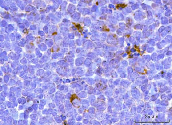TFEB Rabbit Polyclonal Antibody