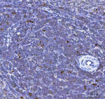 TFEB Rabbit Polyclonal Antibody