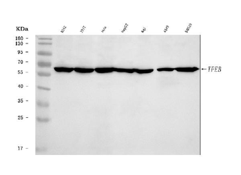 TFEB Rabbit Polyclonal Antibody