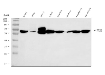 TFEB Rabbit Polyclonal Antibody