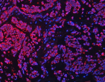 TFEB Rabbit Polyclonal Antibody