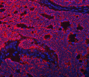TFEB Rabbit Polyclonal Antibody