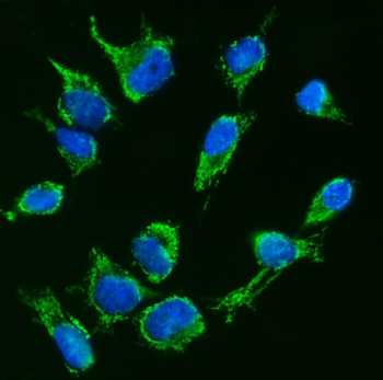 TFEB Rabbit Polyclonal Antibody