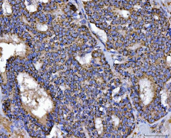 TFEB Rabbit Polyclonal Antibody