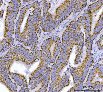TFEB Rabbit Polyclonal Antibody