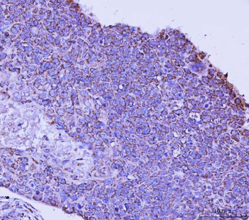 TFEB Rabbit Polyclonal Antibody