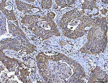 TFEB Rabbit Polyclonal Antibody