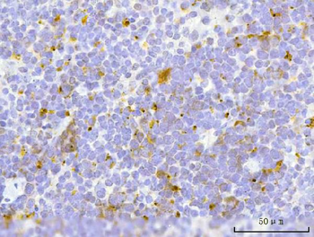 TFEB Rabbit Polyclonal Antibody