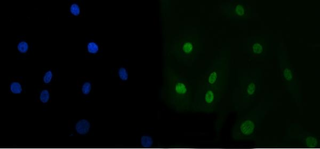 TRBP/TARBP2 Rabbit Polyclonal Antibody