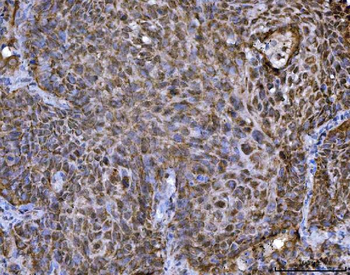 TRBP/TARBP2 Rabbit Polyclonal Antibody