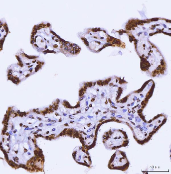 TRBP/TARBP2 Rabbit Polyclonal Antibody