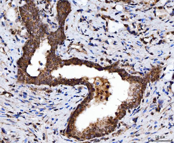 TRBP/TARBP2 Rabbit Polyclonal Antibody