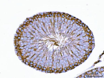 TRBP/TARBP2 Rabbit Polyclonal Antibody