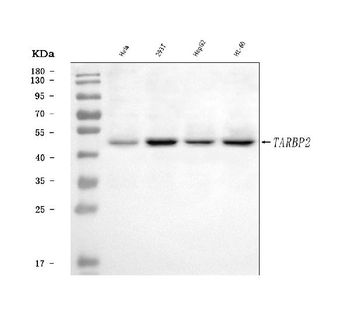 TRBP/TARBP2 Rabbit Polyclonal Antibody