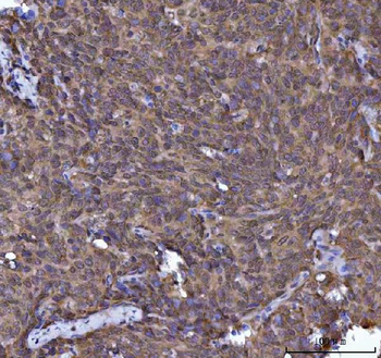 SOCS1 Rabbit Polyclonal Antibody