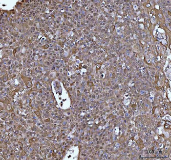 SOCS1 Rabbit Polyclonal Antibody
