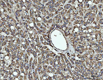 SOCS1 Rabbit Polyclonal Antibody
