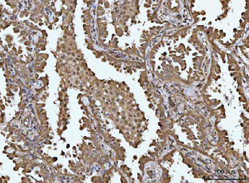 SOCS1 Rabbit Polyclonal Antibody