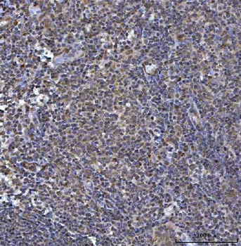 SOCS1 Rabbit Polyclonal Antibody