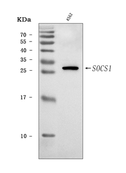 SOCS1 Rabbit Polyclonal Antibody