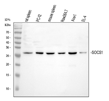 SOCS1 Rabbit Polyclonal Antibody