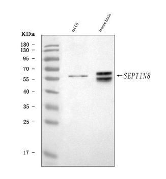 Septin 8/Septin8 Rabbit Polyclonal Antibody