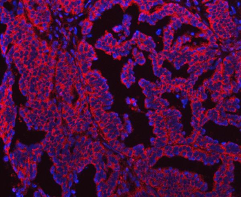SEPT7/SEPTIN7 Rabbit Polyclonal Antibody
