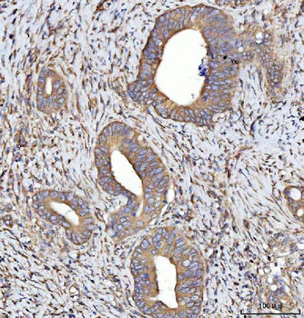 SEPT7/SEPTIN7 Rabbit Polyclonal Antibody