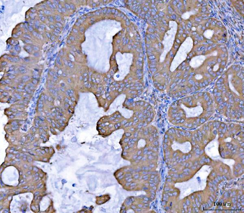 SEPT7/SEPTIN7 Rabbit Polyclonal Antibody