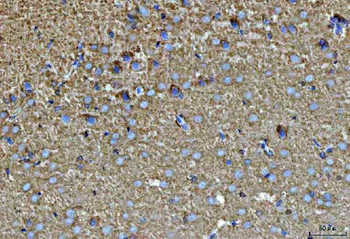 SEPT7/SEPTIN7 Rabbit Polyclonal Antibody