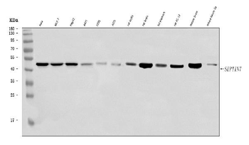 SEPT7/SEPTIN7 Rabbit Polyclonal Antibody
