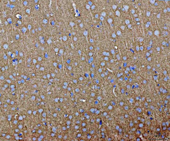 Septin 3/SEPTIN3 Rabbit Polyclonal Antibody