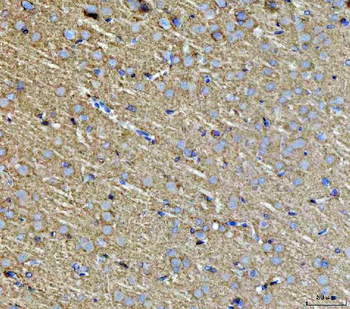 Septin 3/SEPTIN3 Rabbit Polyclonal Antibody