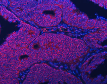 Septin 2/SEPTIN2 Rabbit Polyclonal Antibody