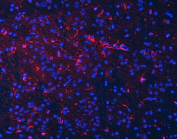 Septin 2/SEPTIN2 Rabbit Polyclonal Antibody