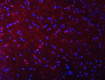 Septin 2/SEPTIN2 Rabbit Polyclonal Antibody