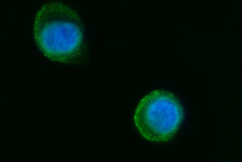 Septin 2/SEPTIN2 Rabbit Polyclonal Antibody