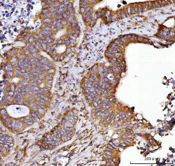 Septin 2/SEPTIN2 Rabbit Polyclonal Antibody