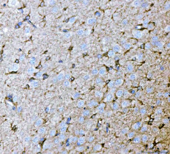 Septin 2/SEPTIN2 Rabbit Polyclonal Antibody