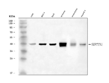LARP/SEPTIN1 Rabbit Polyclonal Antibody