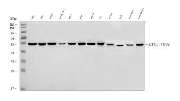 TIP49A/RUVBL1 Rabbit Polyclonal Antibody