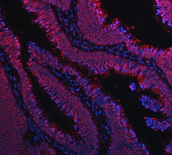 TIP49A/RUVBL1 Rabbit Polyclonal Antibody