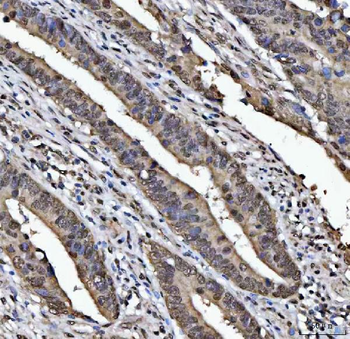 TIP49A/RUVBL1 Rabbit Polyclonal Antibody