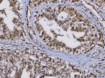 TIP49A/RUVBL1 Rabbit Polyclonal Antibody