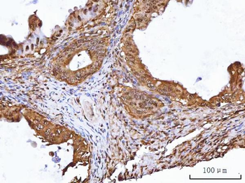 TIP49A/RUVBL1 Rabbit Polyclonal Antibody