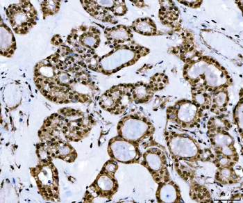 TIP49A/RUVBL1 Rabbit Polyclonal Antibody